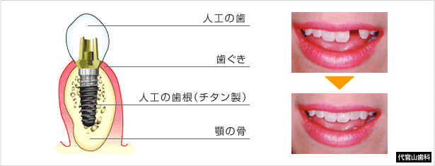CvgÂƂ 摜
