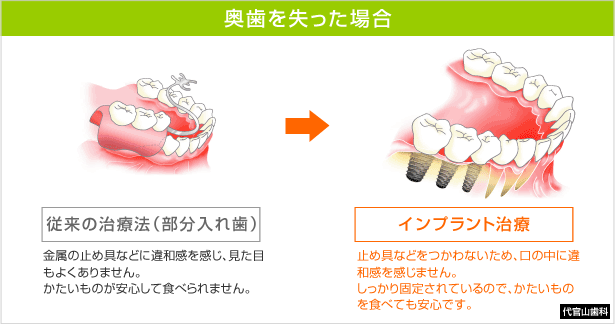 ꍇ