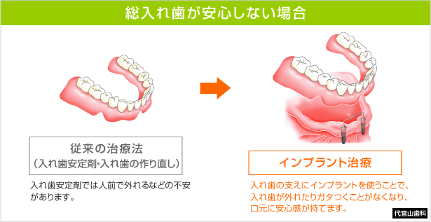 ꎕSȂꍇ