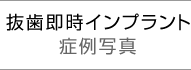 CvgǗʐ^