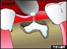 step3