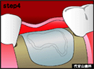 step4