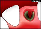 step2