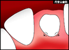 step4